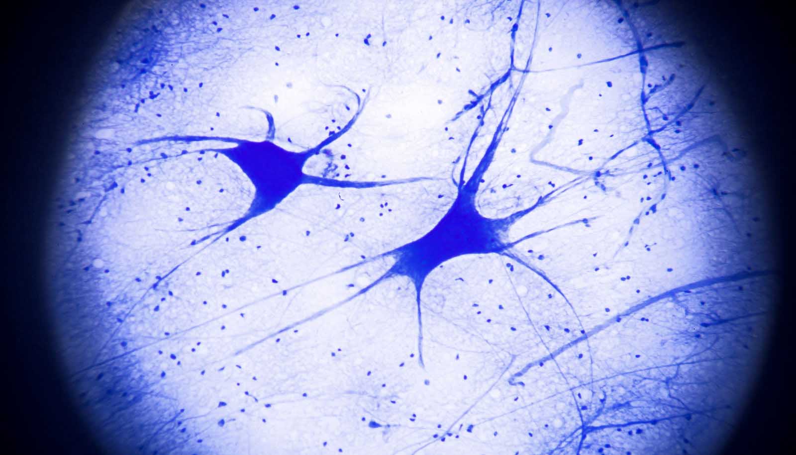 Умершие клетки мозга. Нейрон гистология препарат. Нейрон микрофотография гистология. Клетки нейронов гистология. Нервные клетки под микроскопом гистология.